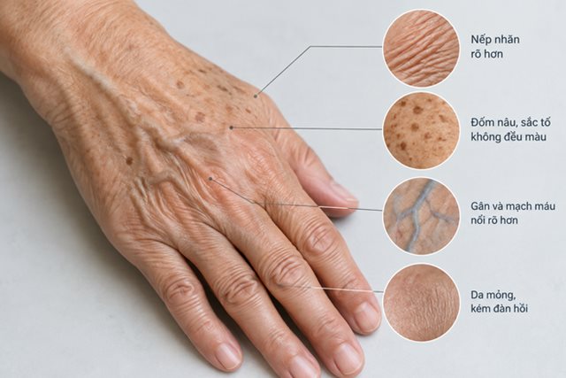 Vì sao da tay dễ lộ tuổi tác?